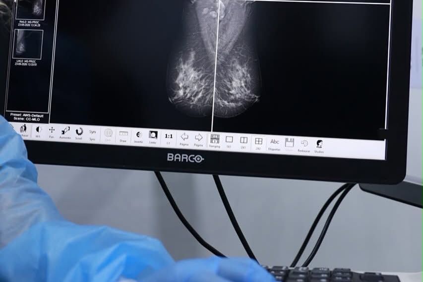 Una detección temprana de cáncer de mama puede salvarte la vida.
