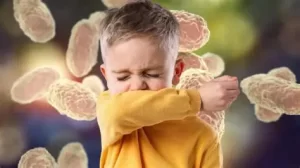 Bebé de seis meses con Sarampión