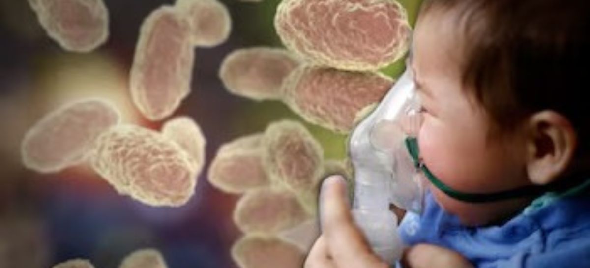 La tosferina enciende alerta sanitaria en Honduras