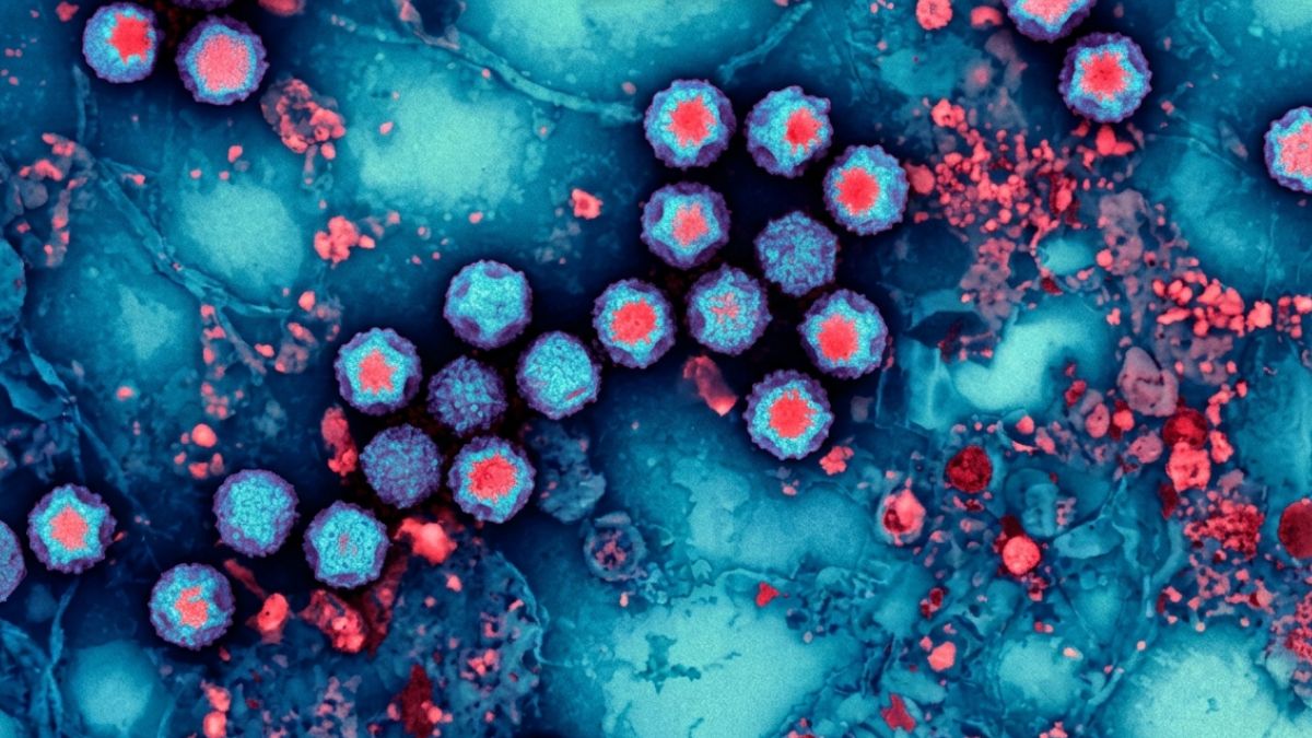 virus
